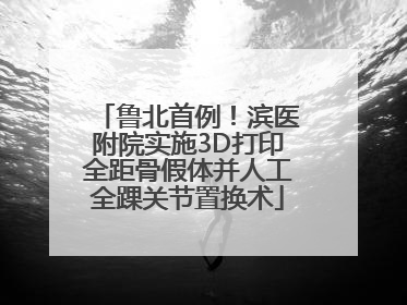 鲁北首例！滨医附院实施3D打印全距骨假体并人工全踝关节置换术